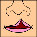 unilateral incomplete cleft lip/palate